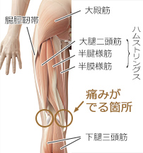 の 裏側 痛み 膝