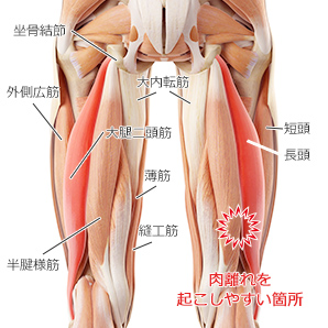 肉離れを改善 筋肉チューニング整体院uroom ゆーるーむ