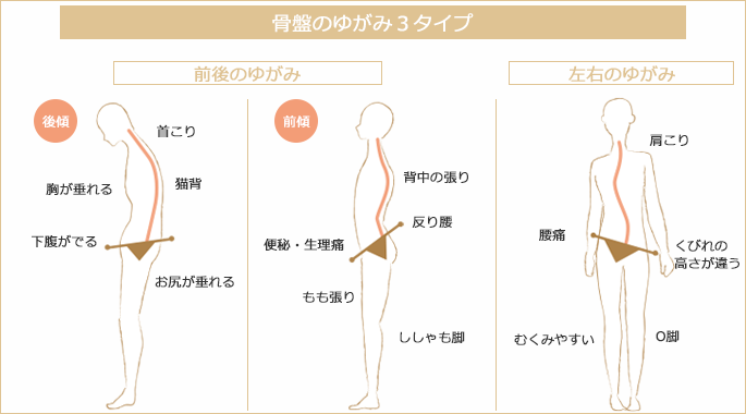 骨盤矯正で痛みを改善 ミオンパシー整体院uroom ゆーるーむ